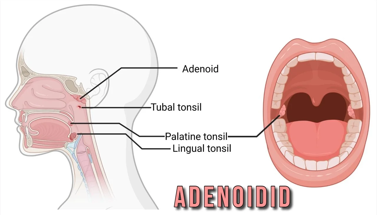 adenoidid
